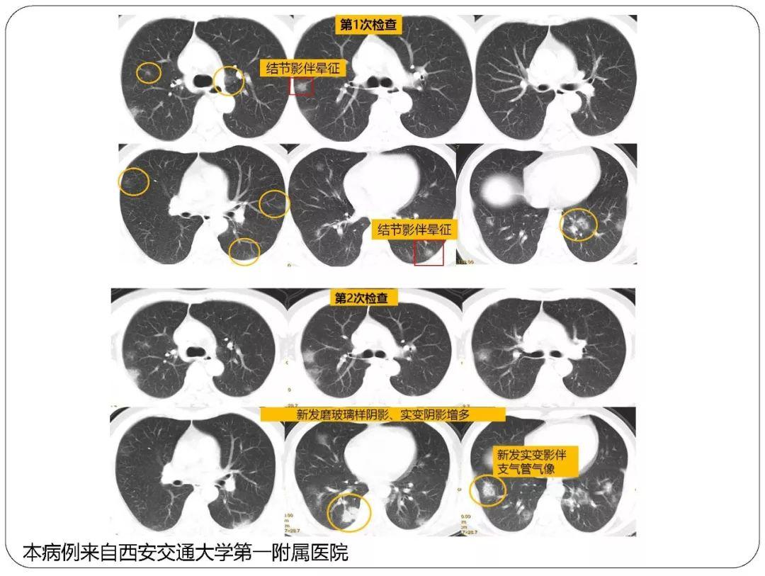 最新病毒特征下的自然探索之旅，内心平静与喜悦的追求