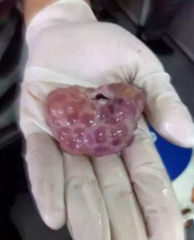 窝精子最新论述概述