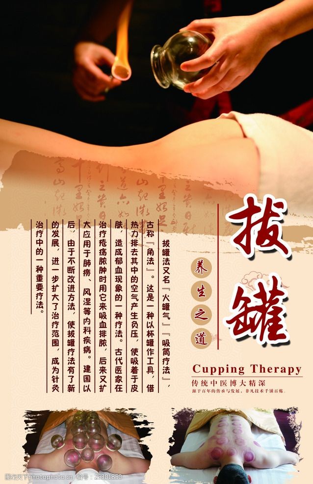 最新拔火罐，古老时尚的健康疗法体验